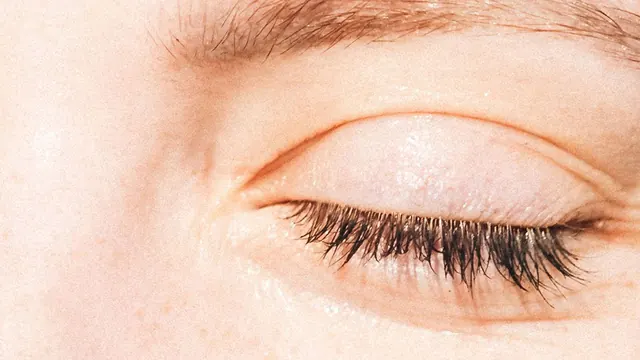 Could the Skin-Tightening XERF Treatment Be the Perfect Wedding Prep?